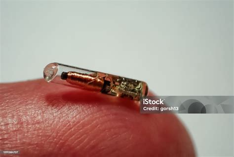 A radio frequency identification implanted in a tooth can 